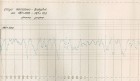 Wykres nierówności przy użyciu planografu cięgnionego za samochodem